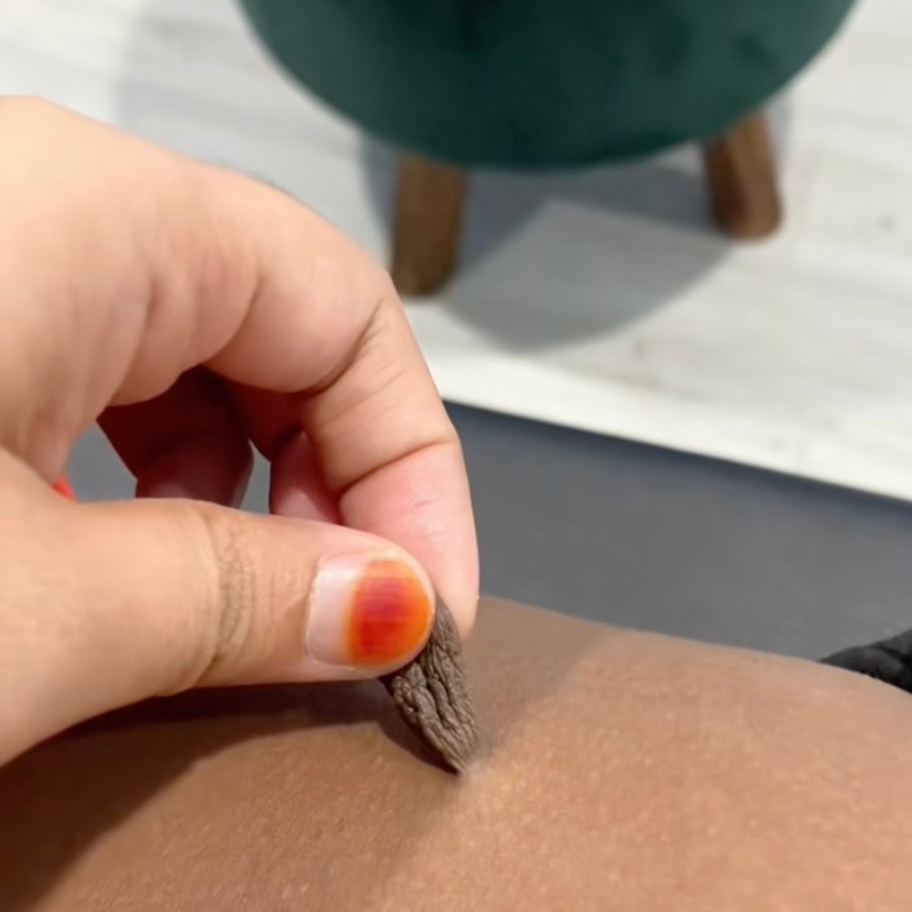 Éliminateur d’excroissances de peau (Anti-acrochordons)